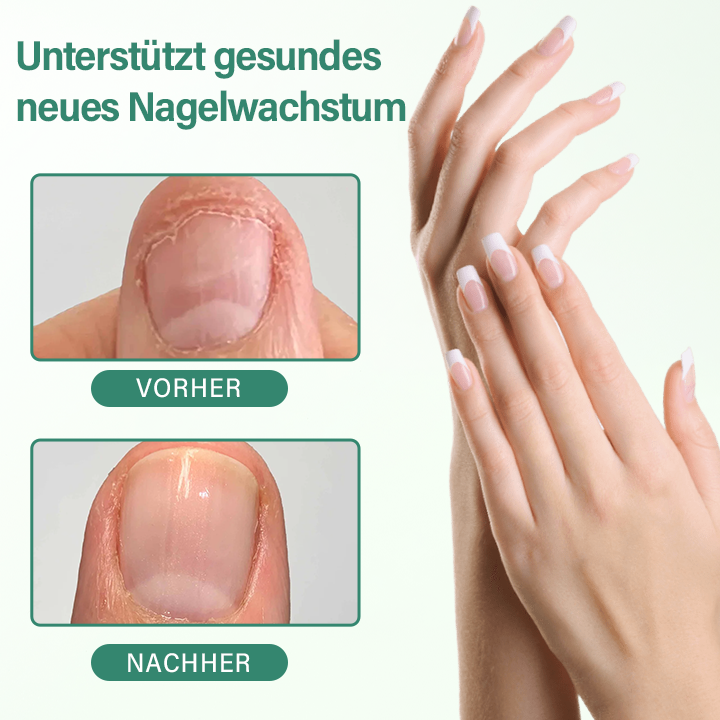 Ceoerty® Nagel-Detox Tiefenwirksames Serum-Pen
