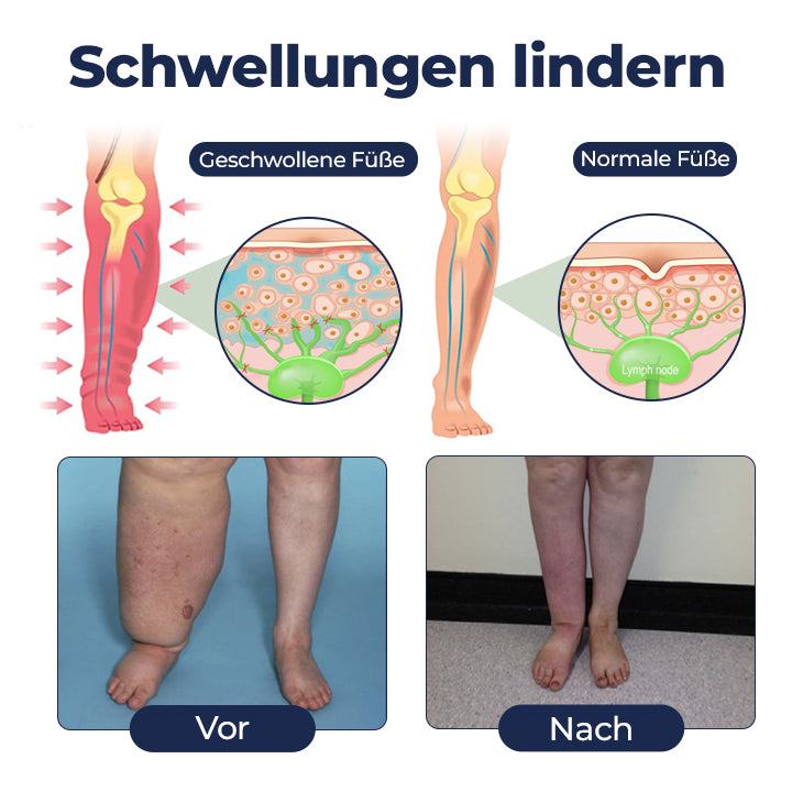 Timilk® SwellRelief Durchblutungsunterstützende Creme