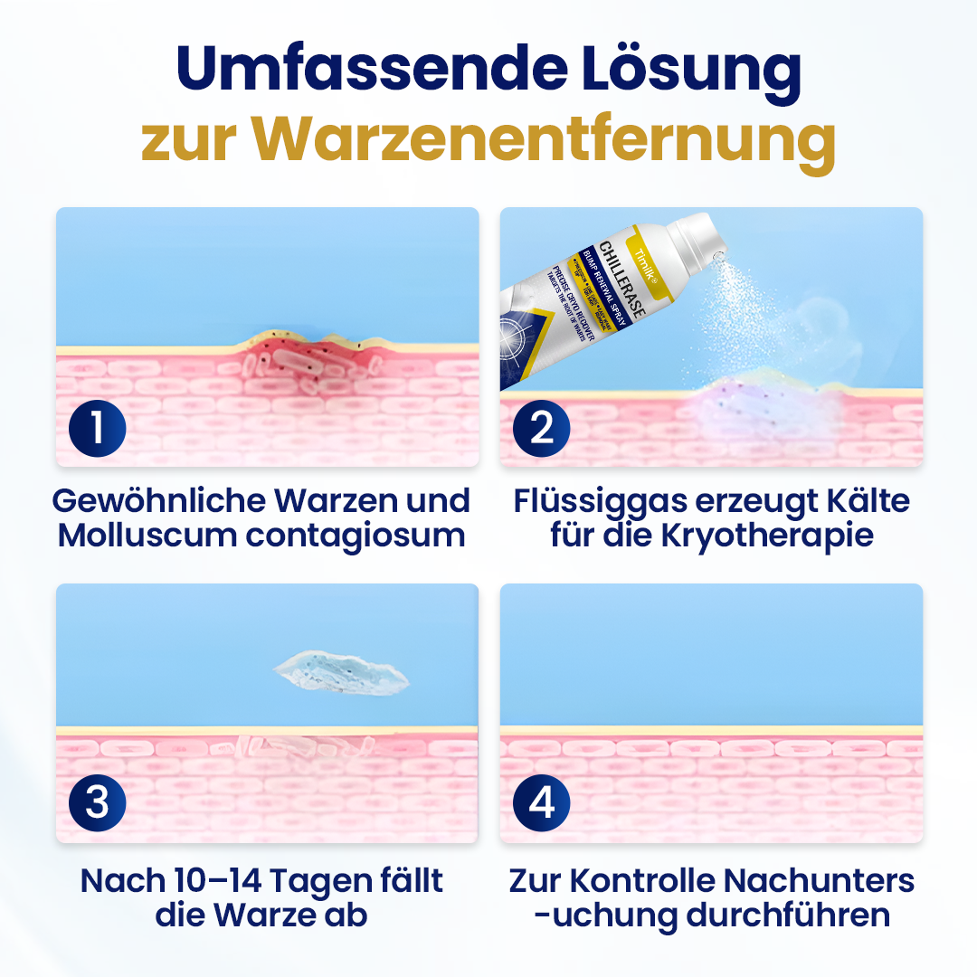 Timilk® ChillErase Erneuerungs-Spray gegen Hautunreinheiten 🔥