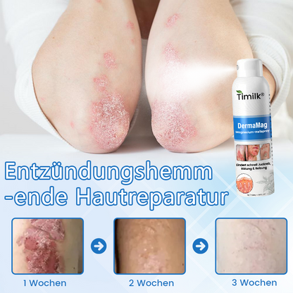 Timilk® DermaMag Magnesium-Reparaturspray 🔥