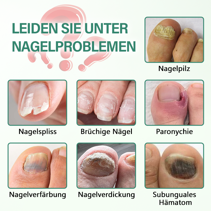 Ceoerty® Nagel-Detox Tiefenwirksames Serum-Pen