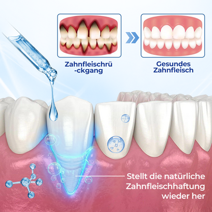 Biancat® BeeTakt Zahnfleisch-Repair Lösung ✨