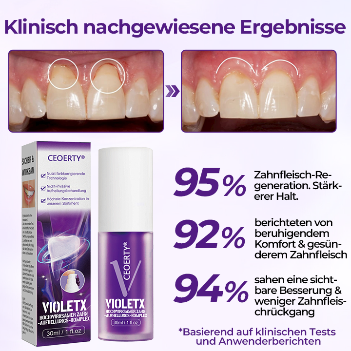 Ceoerty® VioletX Hochwirksamer Zahnaufhellungs-Komplex