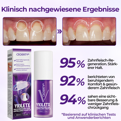 Ceoerty® VioletX Hochwirksamer Zahnaufhellungs-Komplex