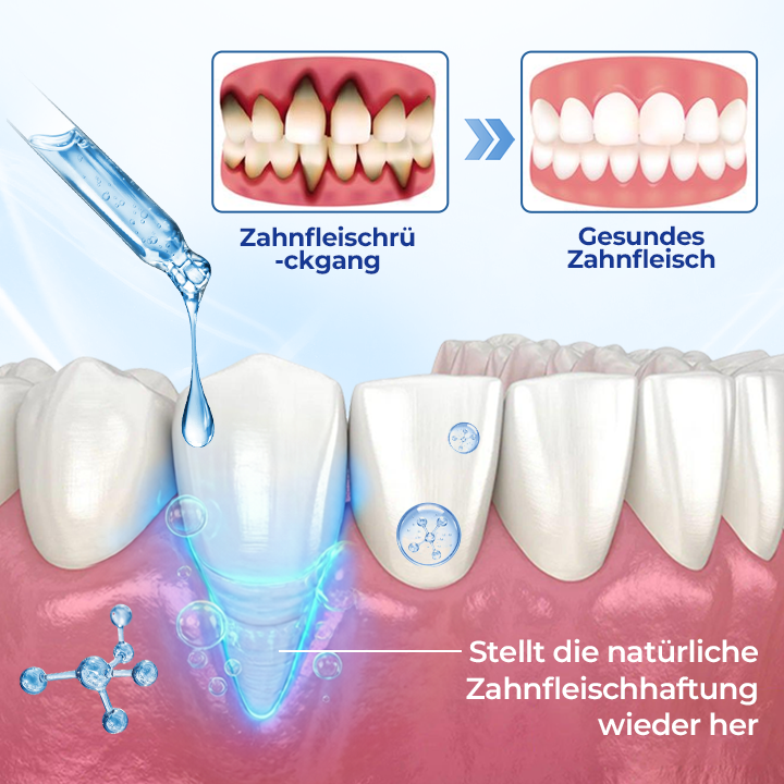 Biancat® BeeTakt Zahnfleisch-Repair Lösung🔥
