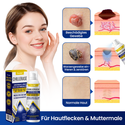Timilk® ChillErase Erneuerungs-Spray gegen Hautunr❤️‍🔥