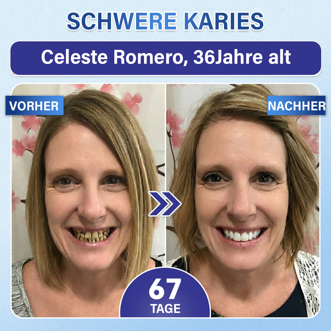 Ceoerty® Zahn- und Zahnfleischpflege – schnell lösliches Mikronadel-Pflaster