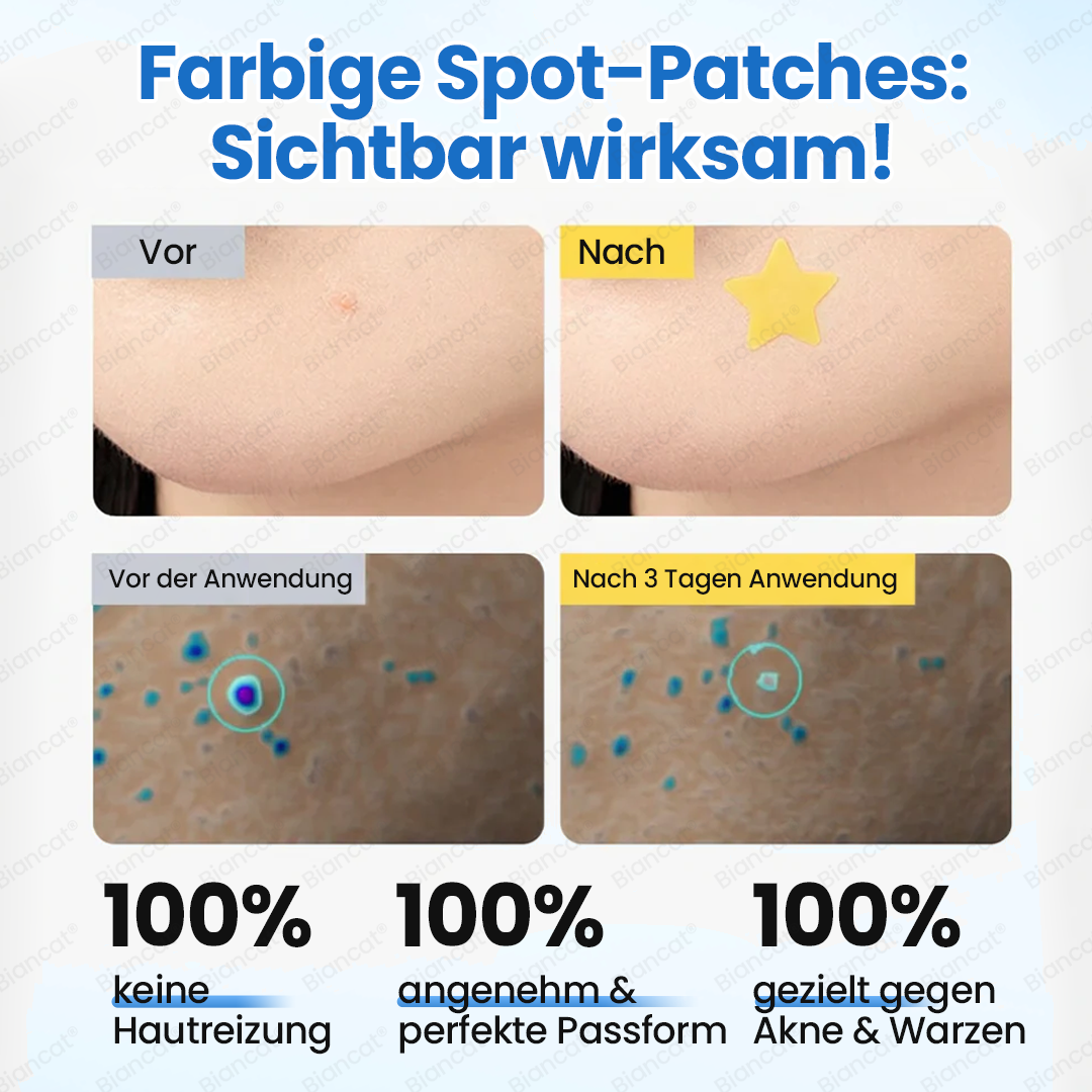 Biancat® MicroHydro 2-in-1 Mikronadel-Patch