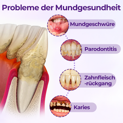 Ceoerty® VioletX Hochwirksamer Zahnaufhellungs-Komplex