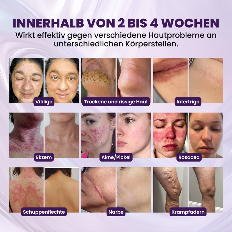 Biancat® BiotinDerm 10-in-1 Haut-Regenerationscreme
