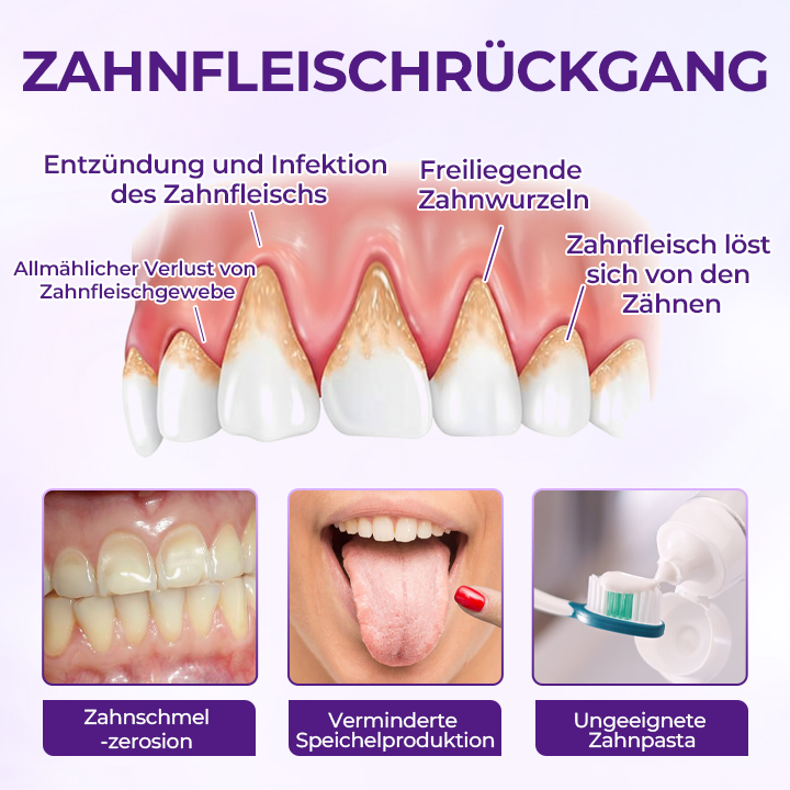 Ceoerty® VioletX Hochwirksamer Zahnaufhellungs-Komplex