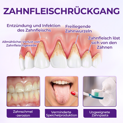 Ceoerty® VioletX Hochwirksamer Zahnaufhellungs-Komplex