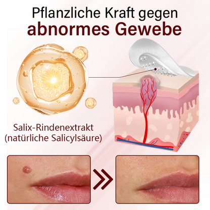 Timilk® Vionara Nano Warzenentfernungs-Pflaster-KeraErase 🔥