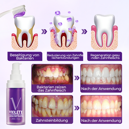 Ceoerty® VioletX Hochwirksamer Zahnaufhellungs-Komplex