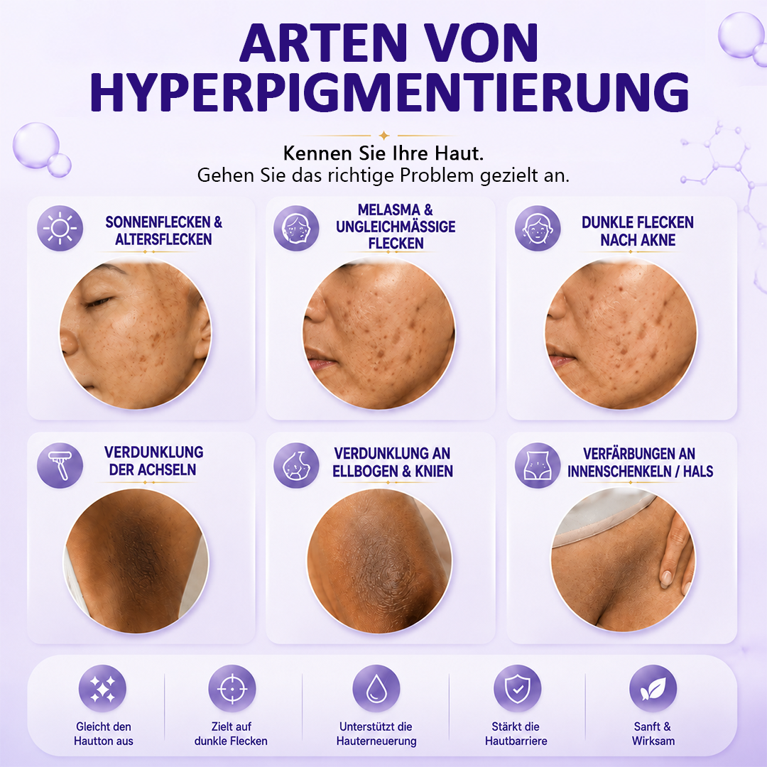 Ceoerty® LumiFade Advanced Anti-Pigmentflecken-Serum