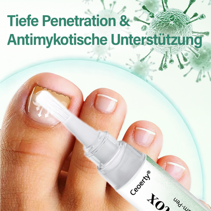 Ceoerty® Nagel-Detox Tiefenwirksames Serum-Pen