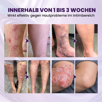 Biancat® BiotinDerm 10-in-1 Haut-Regenerationscreme