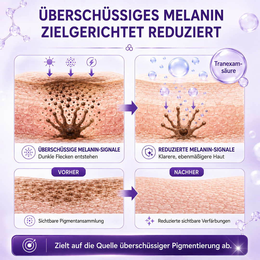 Ceoerty® LumiFade Advanced Anti-Pigmentflecken-Serum