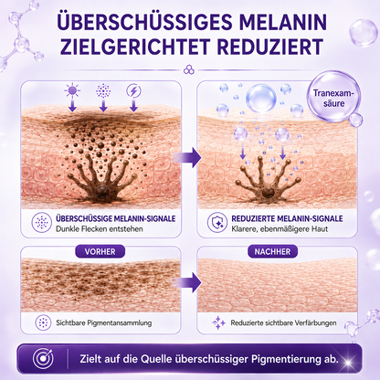 Ceoerty® LumiFade Advanced Anti-Pigmentflecken-Serum