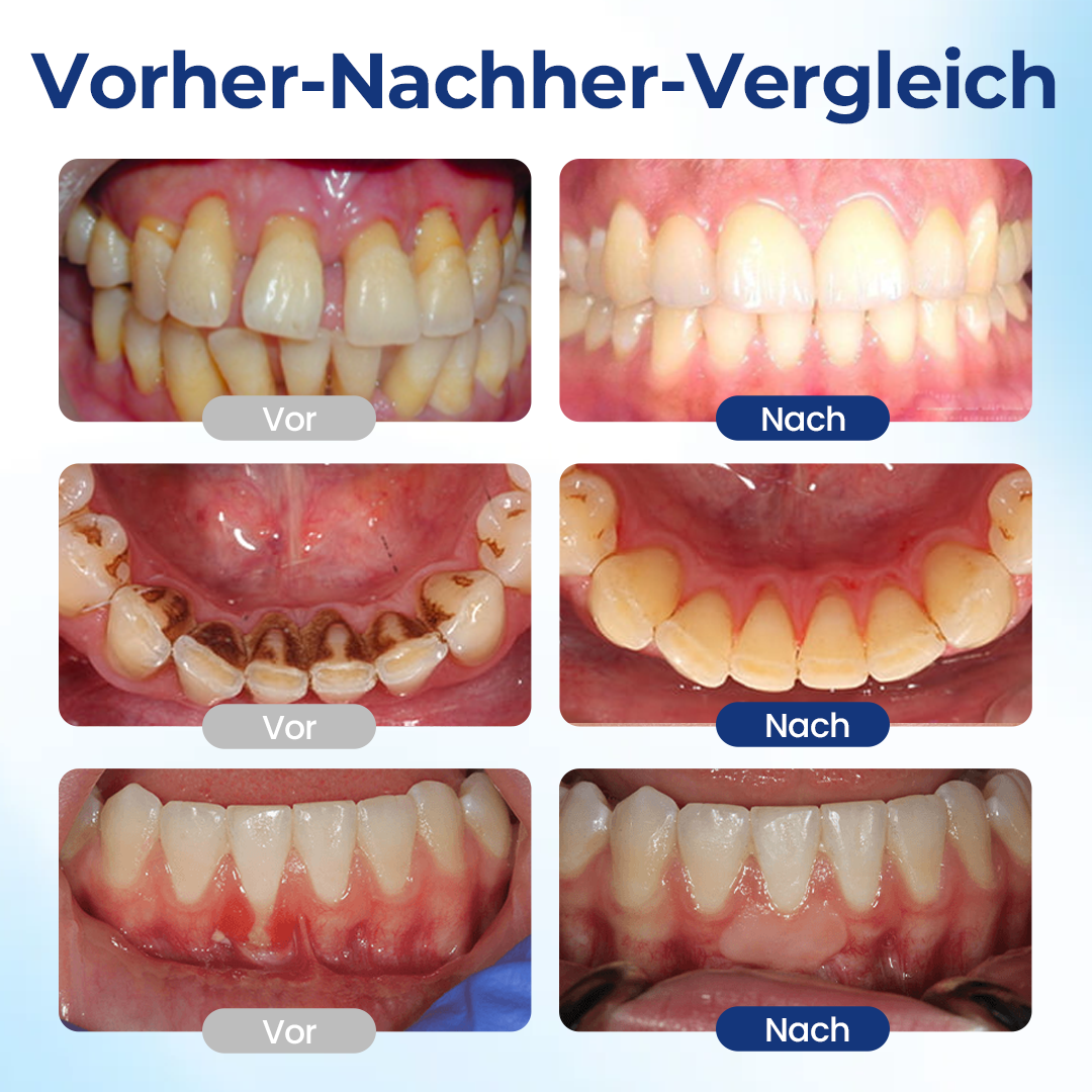 Biancat® BeeTakt Zahnfleisch-Repair Lösung ✨