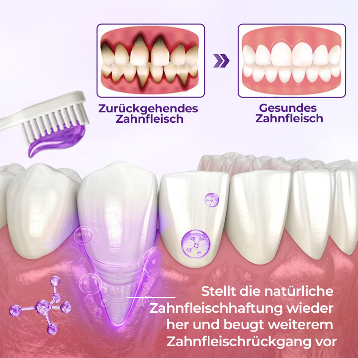 Ceoerty® VioletX Hochwirksamer Zahnaufhellungs-Komplex