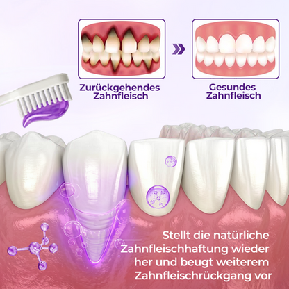 Ceoerty® VioletX Hochwirksamer Zahnaufhellungs-Komplex