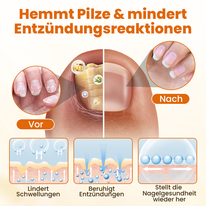 Timilk® FungiBee Fortschrittliches Nagelreparatur-Spray