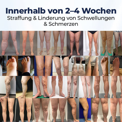 Timilk® SwellRelief Durchblutungsunterstützende Creme