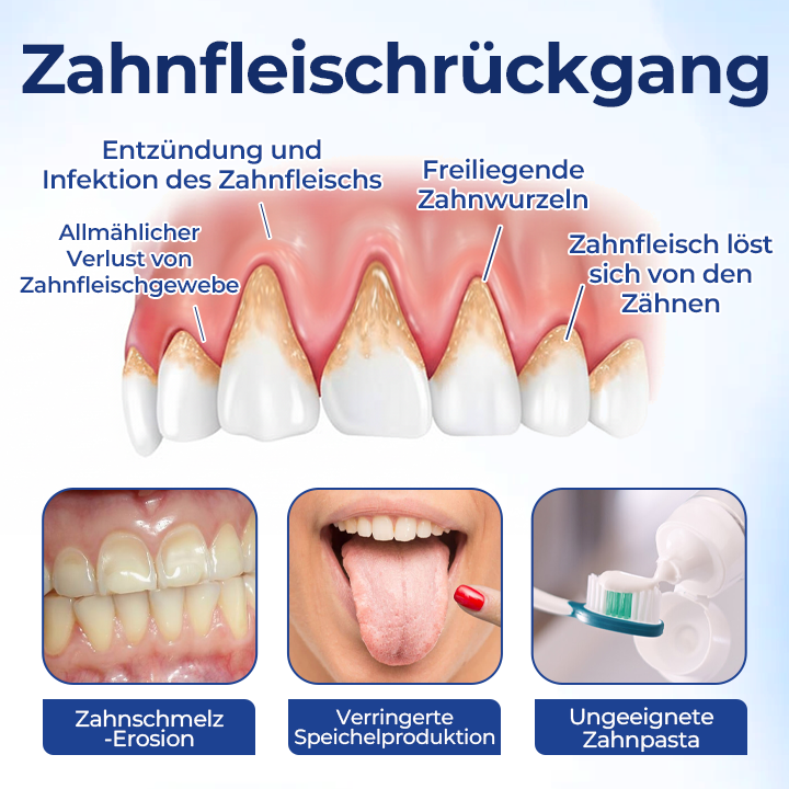 Biancat® BeeTakt Zahnfleisch-Repair Lösung ✨