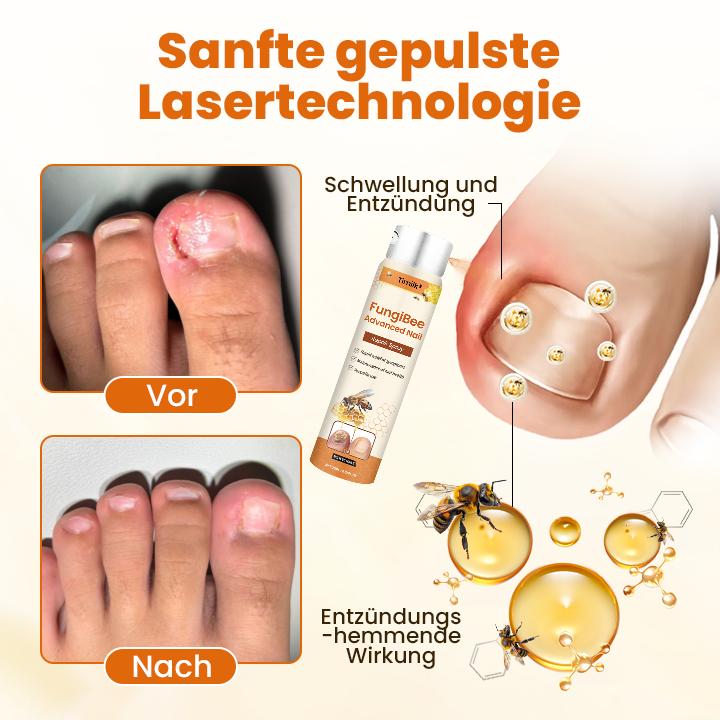 Timilk® FungiBee Fortschrittliches Nagelreparatur-Spray
