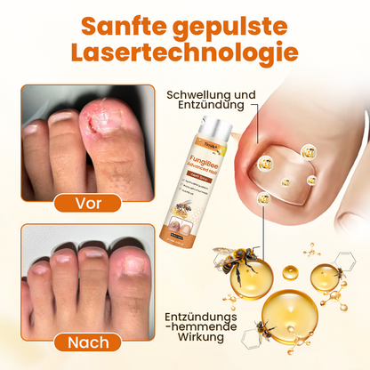 Timilk® FungiBee Fortschrittliches Nagelreparatur-Spray