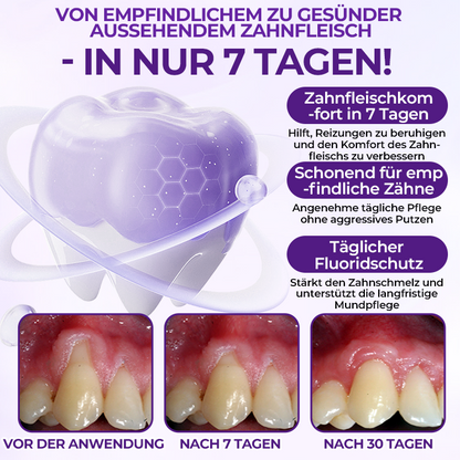 Ceoerty® VioletX Hochwirksamer Zahnaufhellungs-Komplex