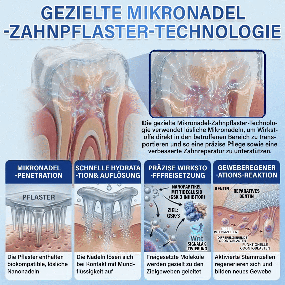 Ceoerty® Zahn- und Zahnfleischpflege – schnell lösliches Mikronadel-Pflaster